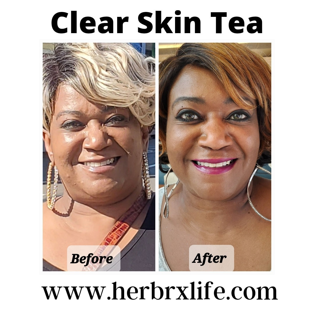 Clear Skin Tea